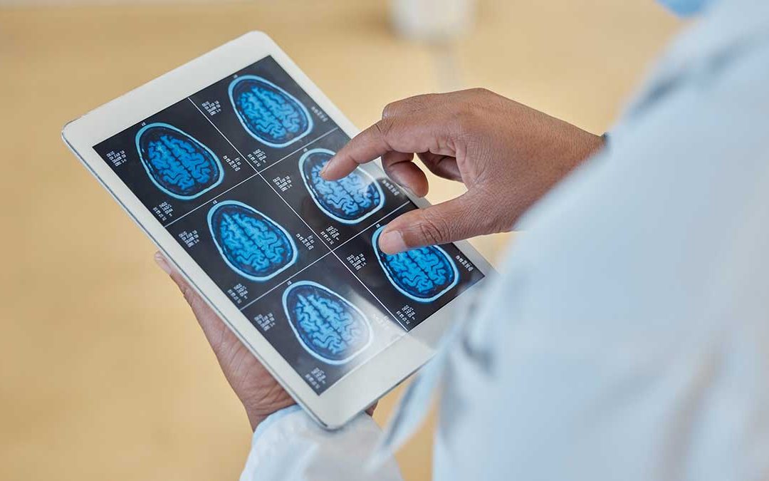Hood River County Sees 3 Cases of Deadly Brain Disease with No Known Link