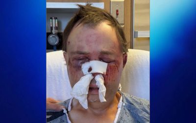 GoFundMe Launched for Prineville Man Blinded in Brutal Attack by Mentally Ill Neighbor Claiming to Be a Jedi