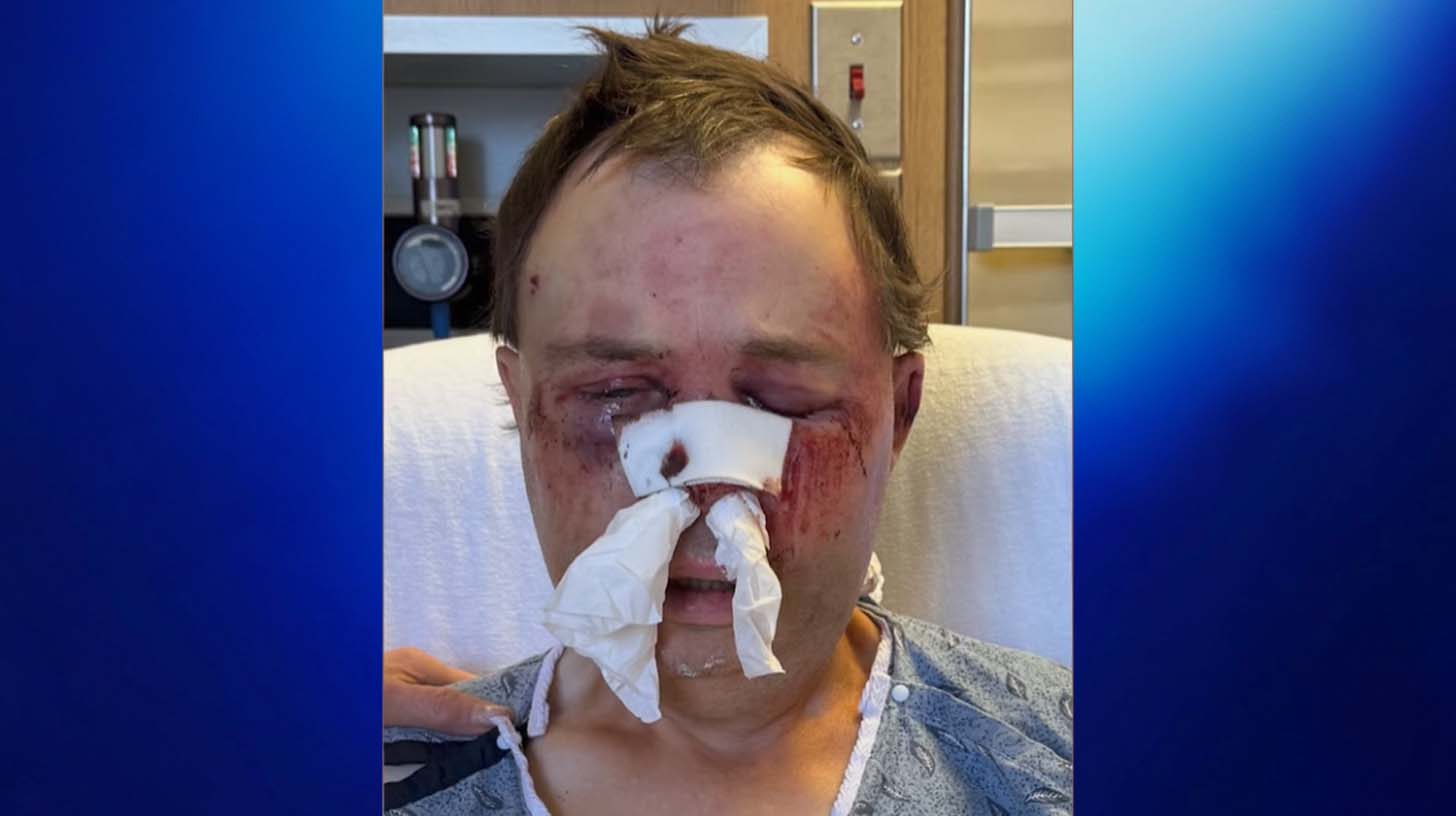 Steve Wilson was a victim of an attack in Prineville, Oregon